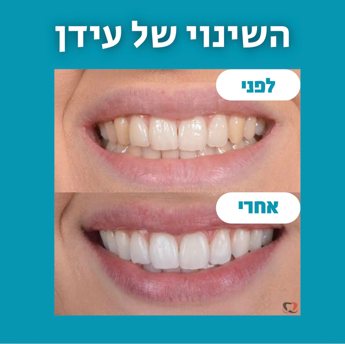 מארז פה בריא - freshly