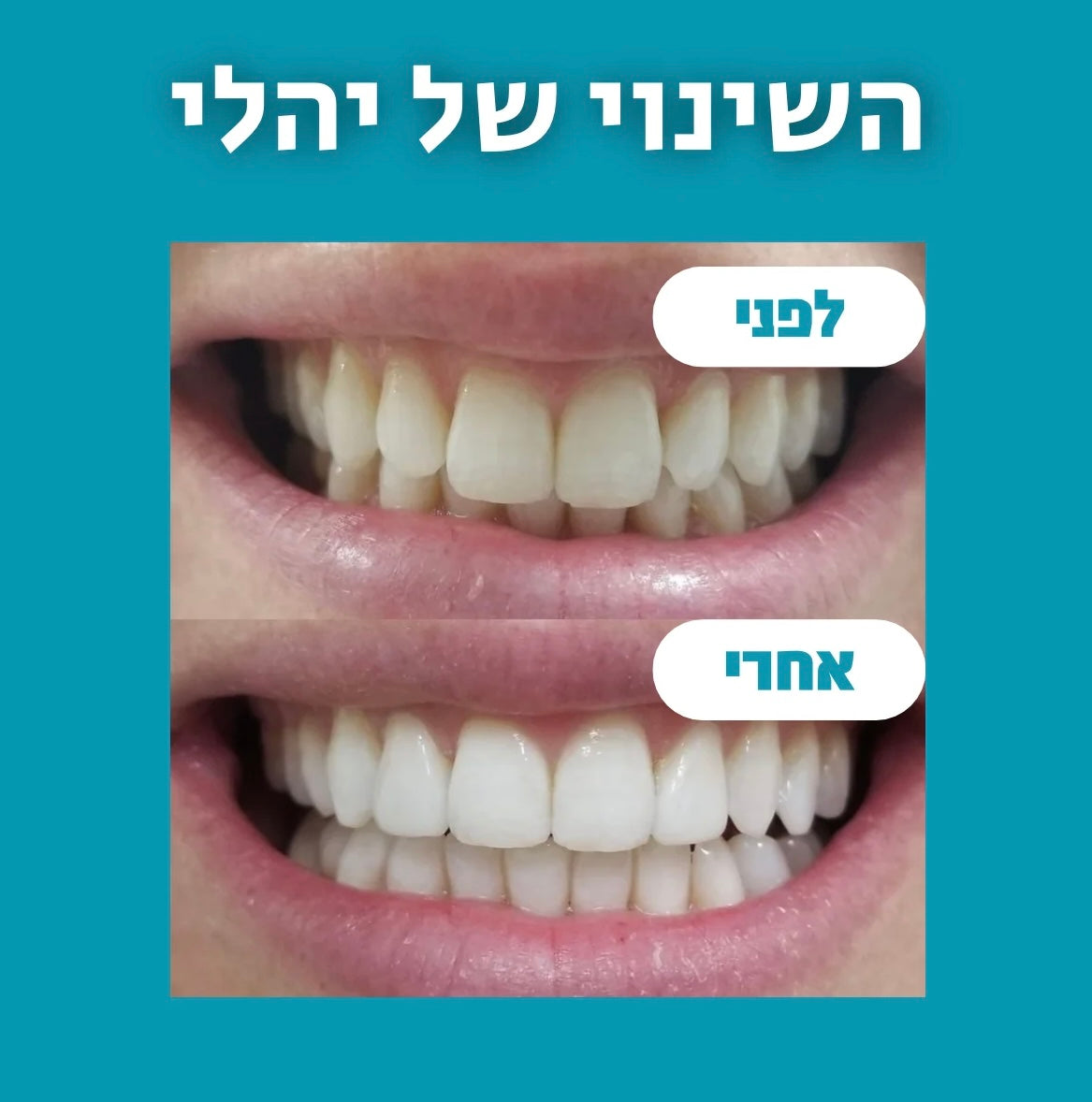 מארז פה בריא - freshly